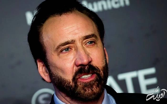 عمل زیبایی افراد مشهور لمینت دندان افراد مشهور